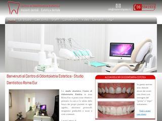 Impianti Dentali Roma